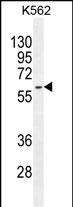 Rabbit Polyclonal Antibody to KRT73