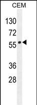 Rabbit Polyclonal Antibody to LIPC (N-term)