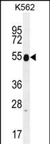 Rabbit Polyclonal Antibody to KRT25