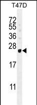Rabbit Polyclonal Antibody to GAGE12B (N-term)