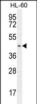 Rabbit Polyclonal Antibody to GPR142 (N-term)