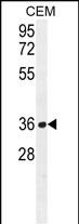 Rabbit Polyclonal Antibody to NUDT22