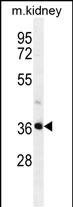 Rabbit Polyclonal Antibody to PIH1D2