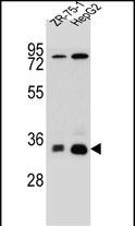 Rabbit Polyclonal Antibody to MTHFD2L