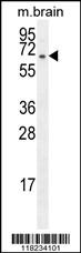 Rabbit Polyclonal Antibody to FBXO21