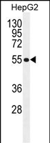Rabbit Polyclonal Antibody to MFS10