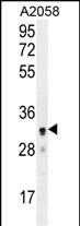 Rabbit Polyclonal Antibody to UBXN2A