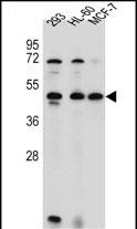 Rabbit Polyclonal Antibody to ANKRD40