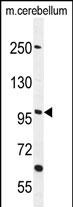 Rabbit Polyclonal Antibody to FAM160B1