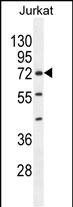 Rabbit Polyclonal Antibody to ZNF648 (N-term)