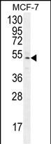 Rabbit Polyclonal Antibody to ZNF829
