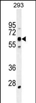 Rabbit Polyclonal Antibody to KRBA2