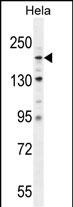 Rabbit Polyclonal Antibody to COL4A2 (N-term)
