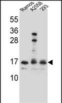 Rabbit Polyclonal Antibody to HOPX