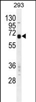 Rabbit Polyclonal Antibody to CPM
