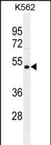 Rabbit Polyclonal Antibody to NUDT19