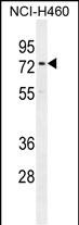 Rabbit Polyclonal Antibody to CCDC63