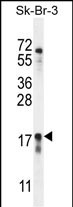 Rabbit Polyclonal Antibody to CA115