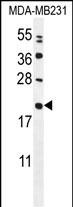 Rabbit Polyclonal Antibody to MIA40