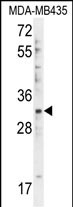Rabbit Polyclonal Antibody to DTWD1