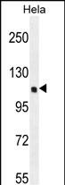 Rabbit Polyclonal Antibody to KIAA0999