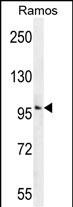 Rabbit Polyclonal Antibody to GUCY2D