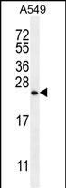 Rabbit Polyclonal Antibody to SNX24 (N-term)