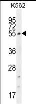 Rabbit Polyclonal Antibody to CCDC61 (N-term)