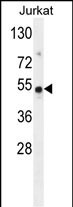 Rabbit Polyclonal Antibody to FAM118B