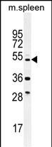 Rabbit Polyclonal Antibody to TTC23L