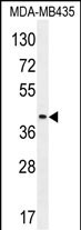 Rabbit Polyclonal Antibody to LILRA5 (N-term)