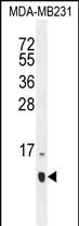 Rabbit Polyclonal Antibody to HCFC1R1 (N-term)