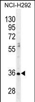 Rabbit Polyclonal Antibody to PRSS21