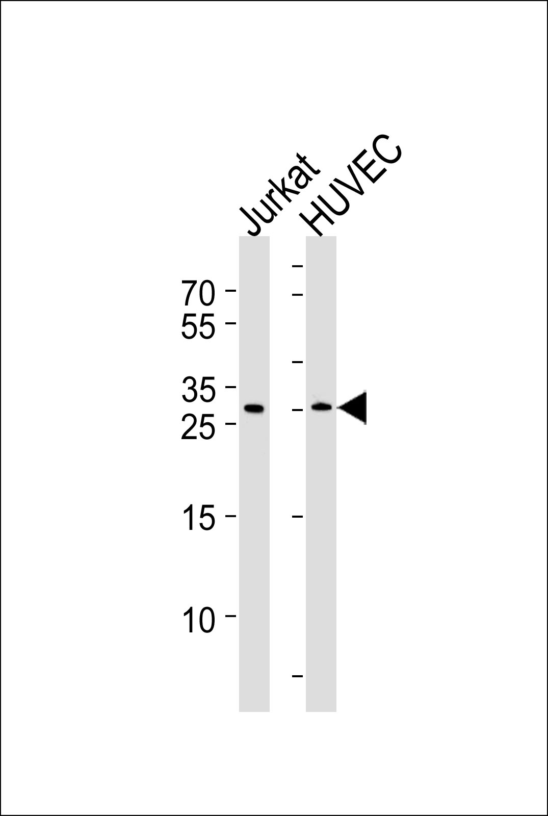 Rabbit Polyclonal Antibody to DKK4