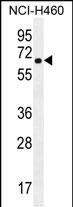 Rabbit Polyclonal Antibody to CHRND