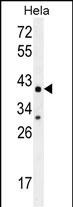 Rabbit Polyclonal Antibody to CYC1