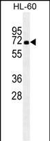 Mouse Monoclonal Antibody to HSPA1A