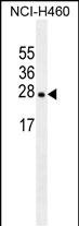 Mouse Monoclonal Antibody to EIF4E2