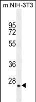 Rabbit Polyclonal Antibody to GFER