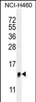 Rabbit Polyclonal Antibody to TMEM100