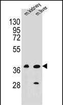 Rabbit Polyclonal Antibody to BRUNOL6 (N-term)