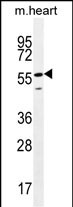 Rabbit Polyclonal Antibody to SMTNL2 (N-term)