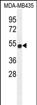 Rabbit Polyclonal Antibody to ZNF286B (N-term)