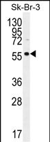 Rabbit Polyclonal Antibody to LOC129293