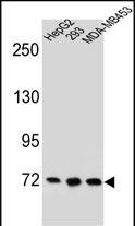 Rabbit Polyclonal Antibody to ZNF860