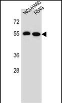 Rabbit Polyclonal Antibody to LRRC6