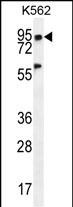 Rabbit Polyclonal Antibody to PLEKHA4 (N-term)