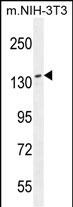 Rabbit Polyclonal Antibody to NUP160