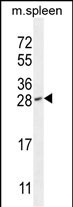 Rabbit Polyclonal Antibody to IAH1