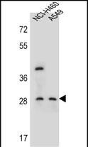 Rabbit Polyclonal Antibody to SPATS1